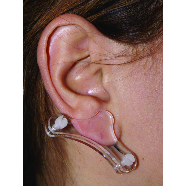 Keloid Pressure Earring (price for 1 ear)